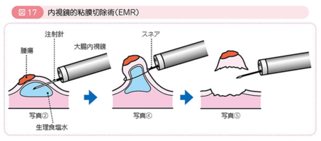 f:id:lady-jhones:20160920200253p:plain