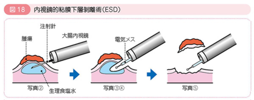 f:id:lady-jhones:20160920200322p:plain