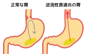 f:id:lady-jhones:20161203000903p:plain f:id:lady-jhones:20161203000903p:plain