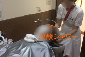 炭酸シャワーで角栓様物質の揉み出し