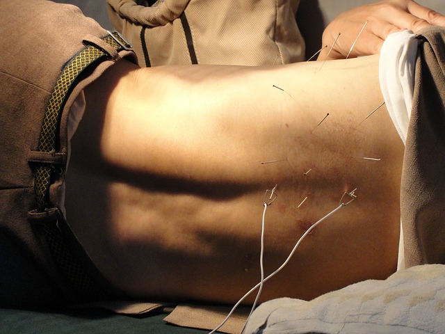 acupuncture