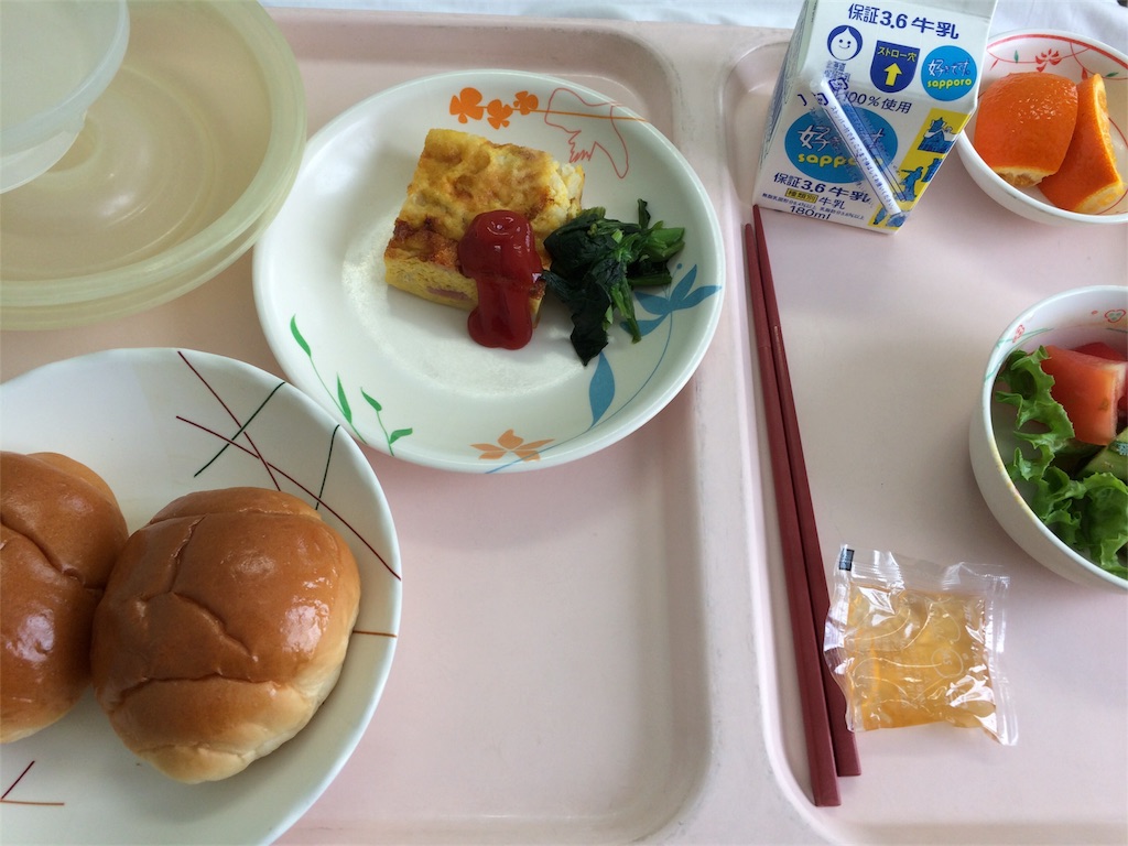 f:id:leiurus:20180424150910j:plain f:id:leiurus:20180424150910j:plain