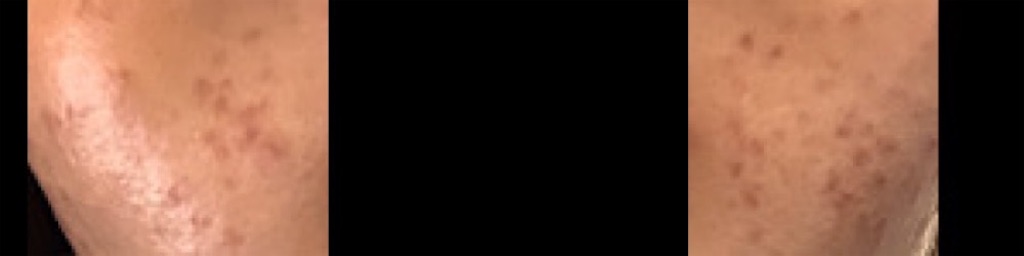 f:id:lemonaroma:20200218235700j:image