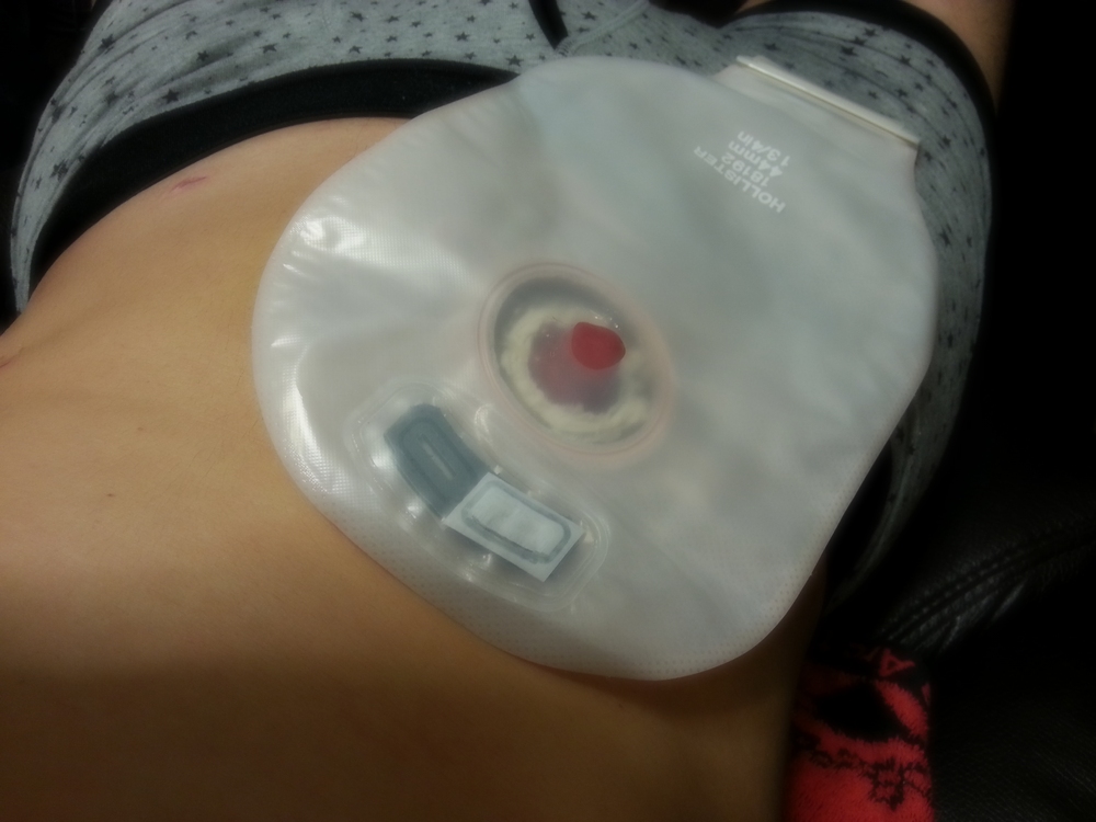 f:id:lephare0126:20170710235717j:plain