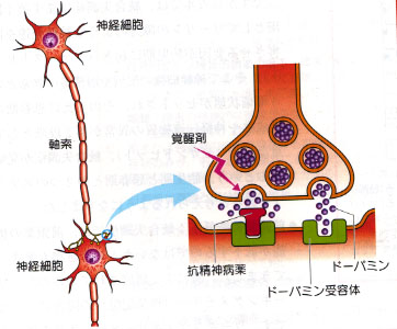 うぉなにーは脳を破壊する