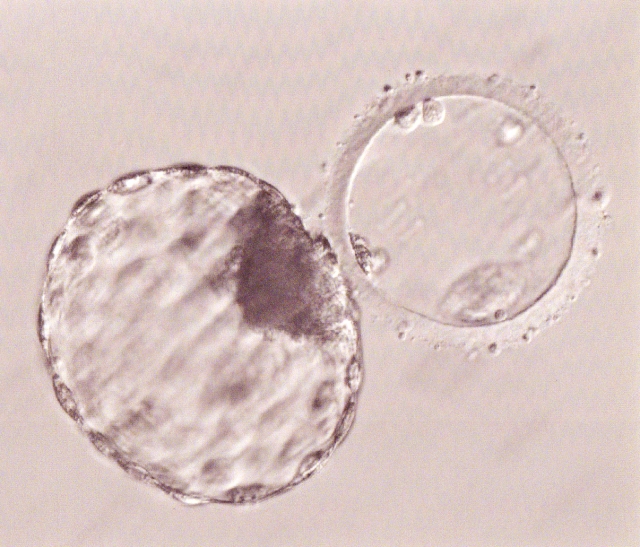 西洋医学が誇りだと思う体外受精