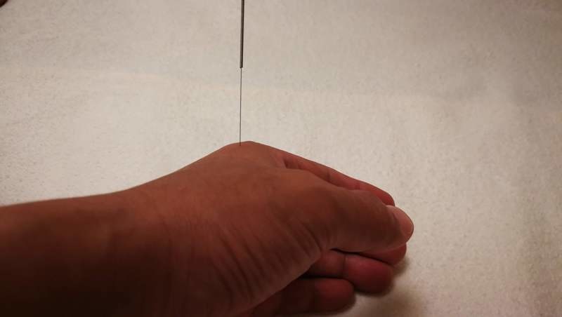 三間穴に鍼1本のみで、風邪の鼻水を治した。
