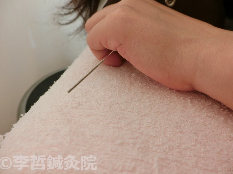 後谿(こうけい):腰痛にも良いし、肩甲骨周りの痛みにも良い。手も暖かくなるツボ。