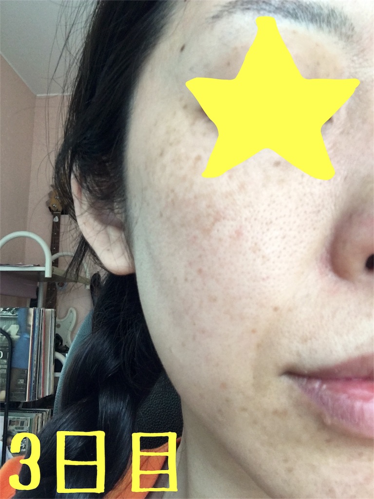 f:id:lifebloguk:20160806171742j:image f:id:lifebloguk:20160806171742j:image