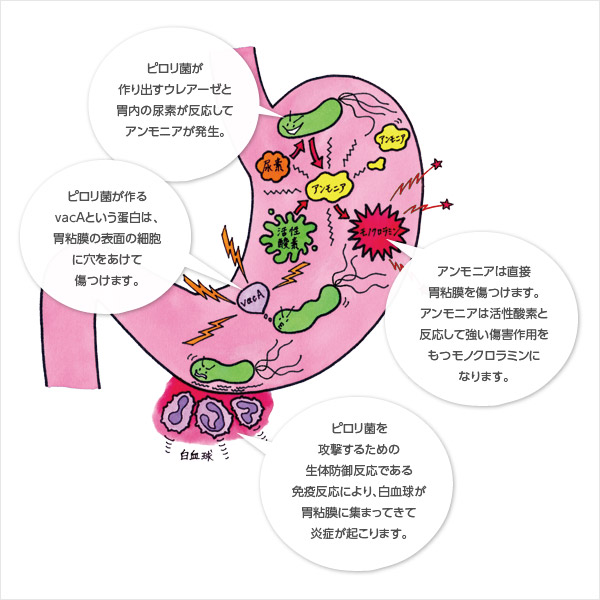 f:id:lifeinformation:20190318173708j:plain f:id:lifeinformation:20190318173708j:plain