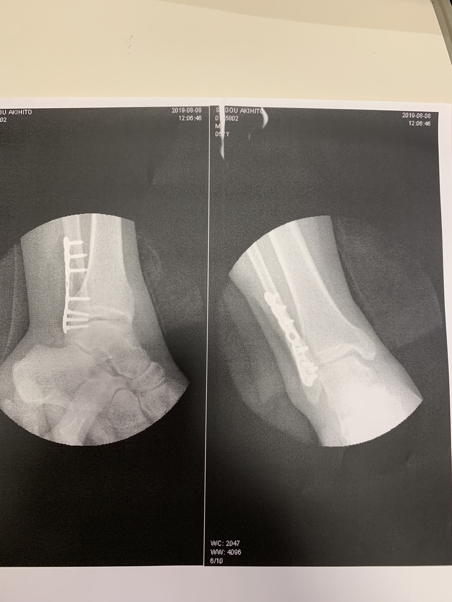 f:id:limited_JunkRoom:20191103162105j:plain