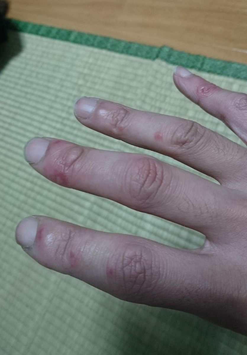 f:id:m6points:20211221221020j:plain