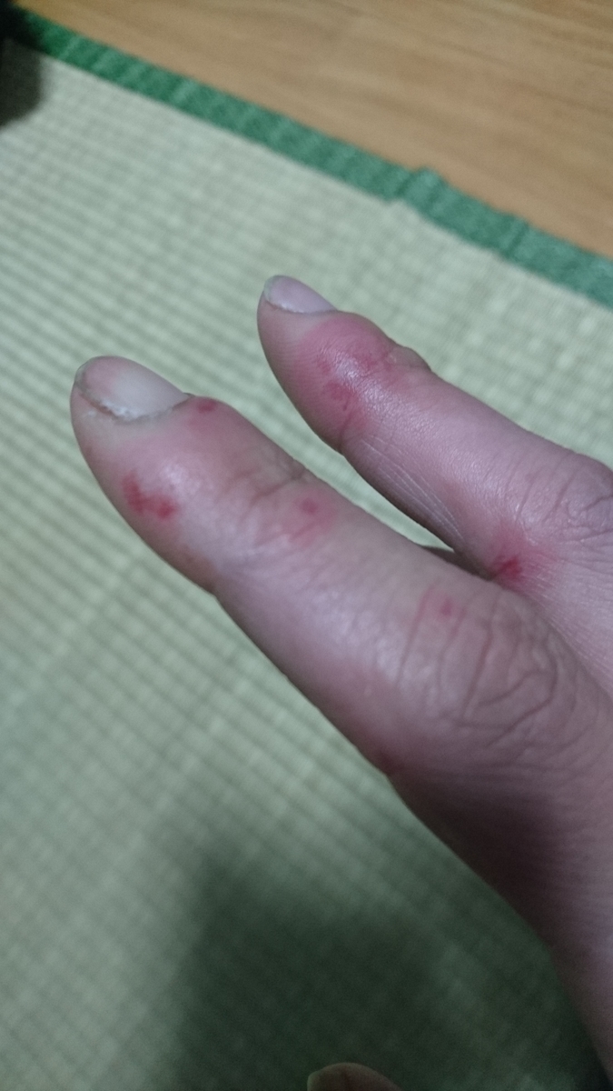 f:id:m6points:20211221221111j:plain