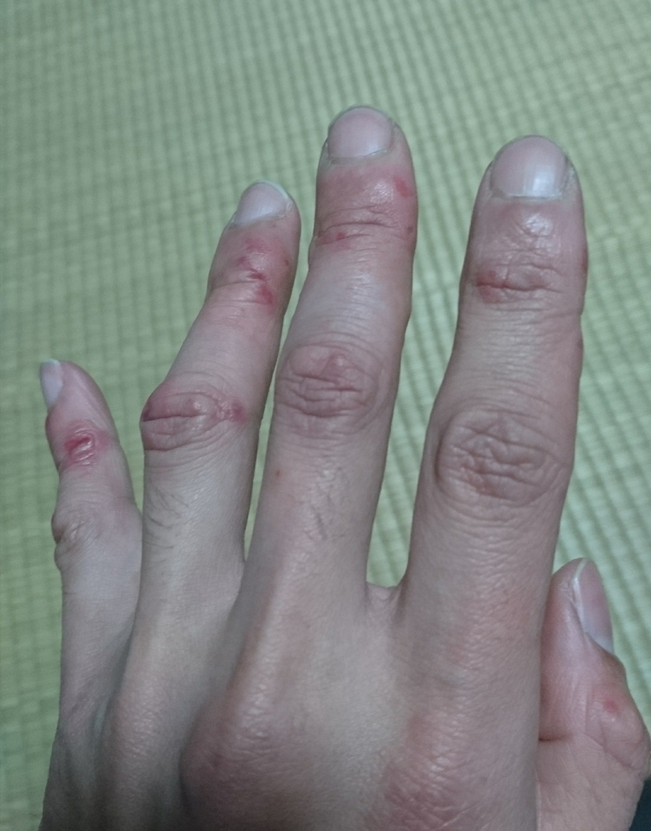 f:id:m6points:20211221221151j:plain