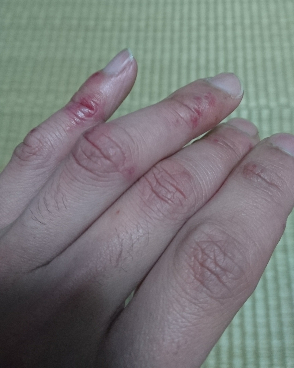 f:id:m6points:20211221221237j:plain