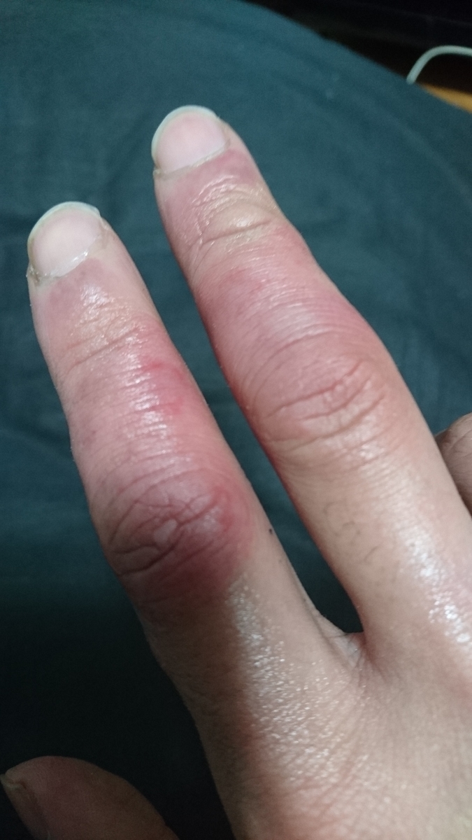 f:id:m6points:20220120210724j:plain