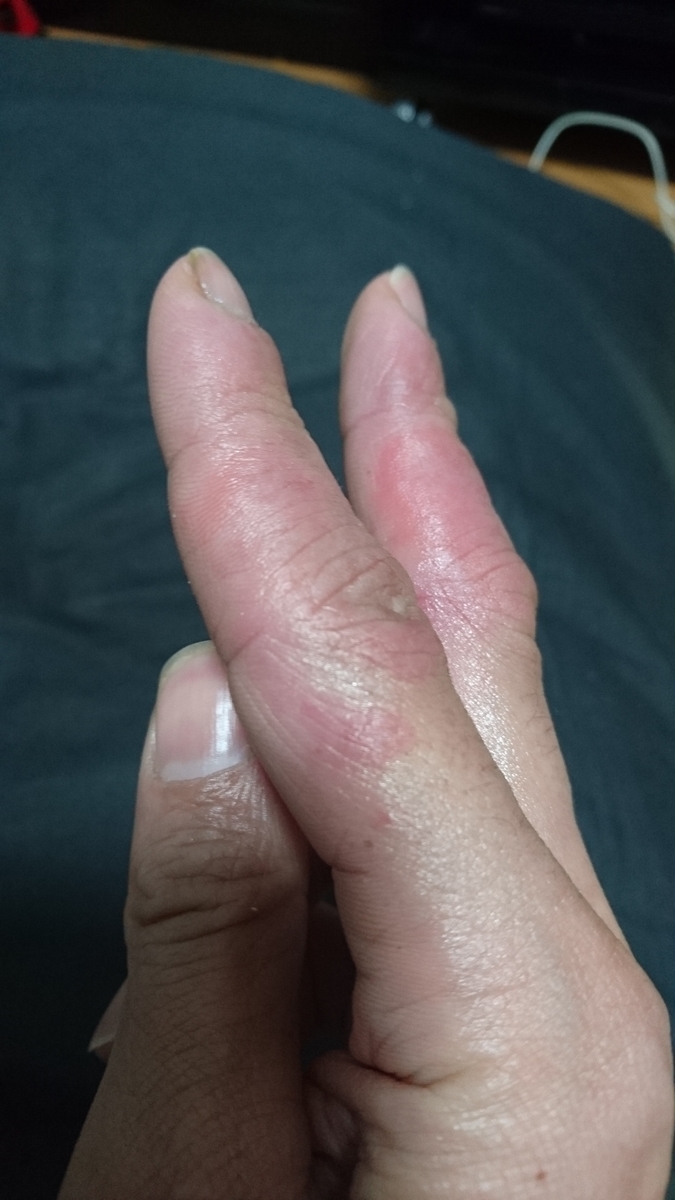 f:id:m6points:20220120210744j:plain