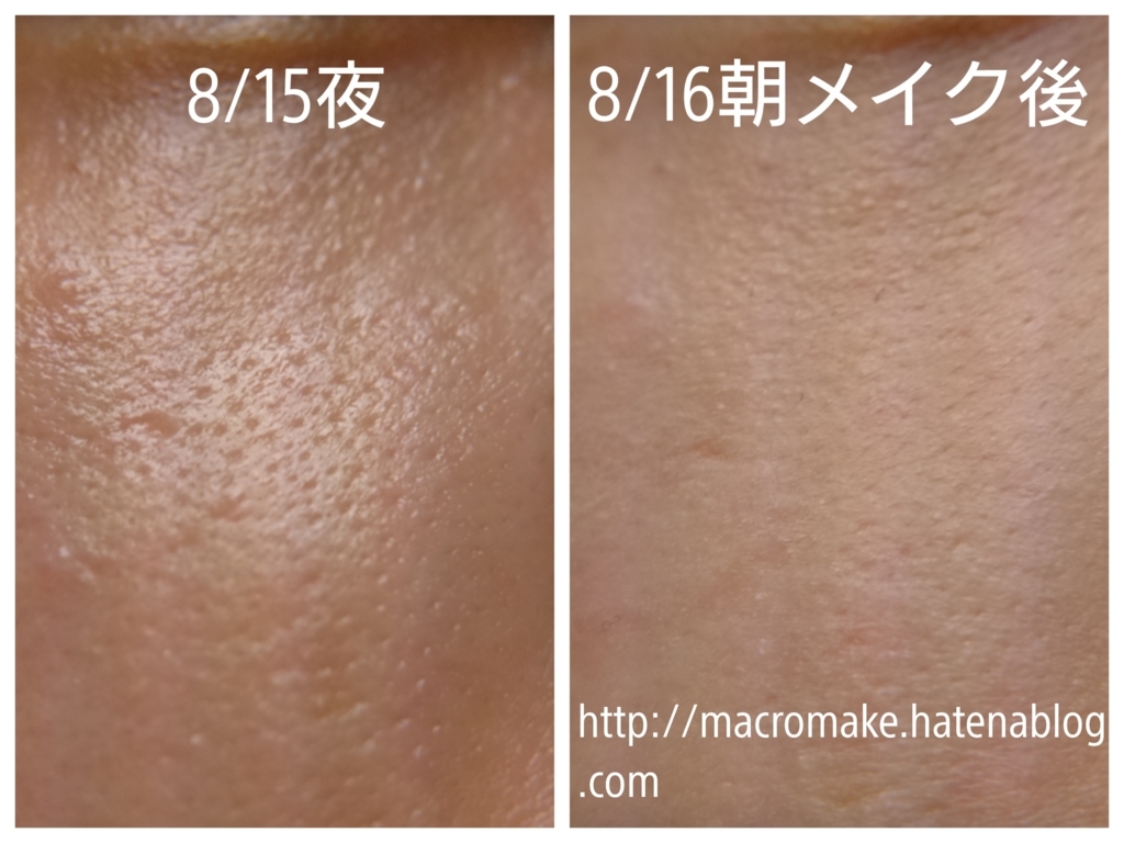 キズパワーパッドの裏技 メイクでどれだけ毛穴が小さくなる たるみ毛穴日記