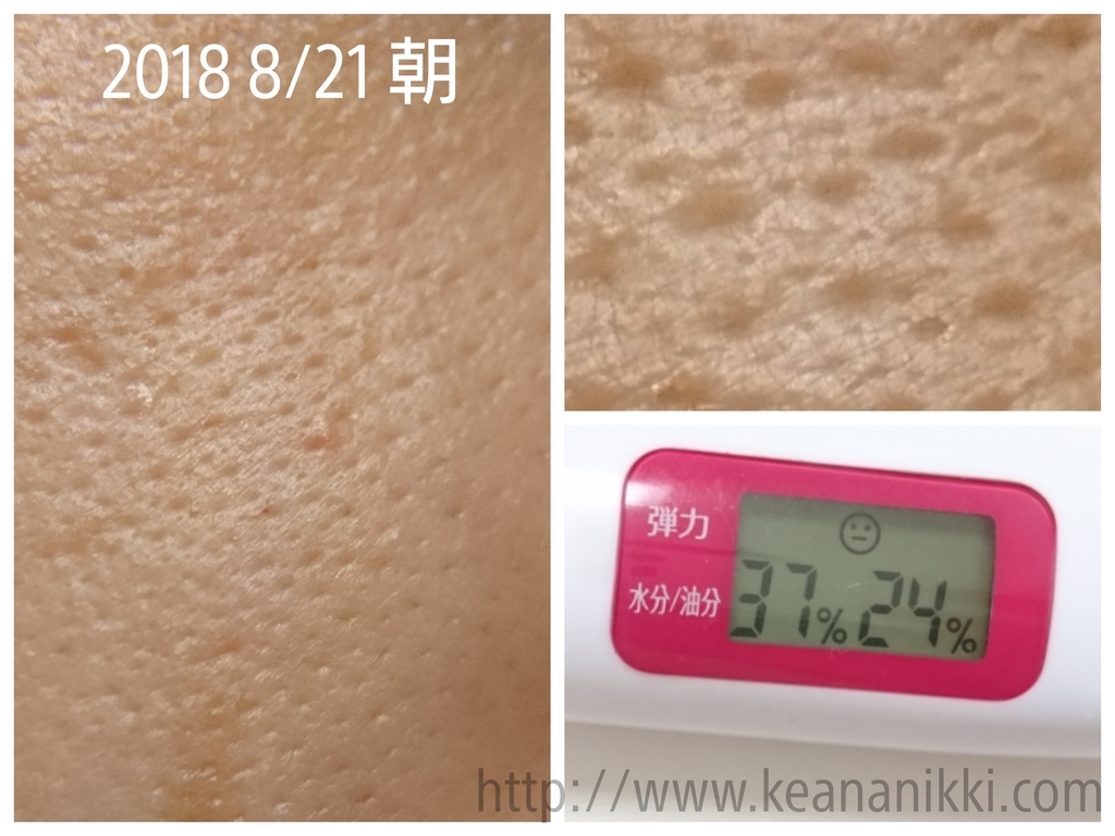 f:id:macromake:20180901101211j:plain f:id:macromake:20180901101211j:plain