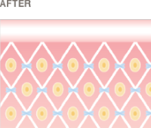AFTERの歯茎のイラスト