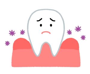 歯周病のイラスト