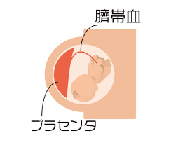 f:id:maemukiworld:20170120022553j:plain f:id:maemukiworld:20170120022553j:plain