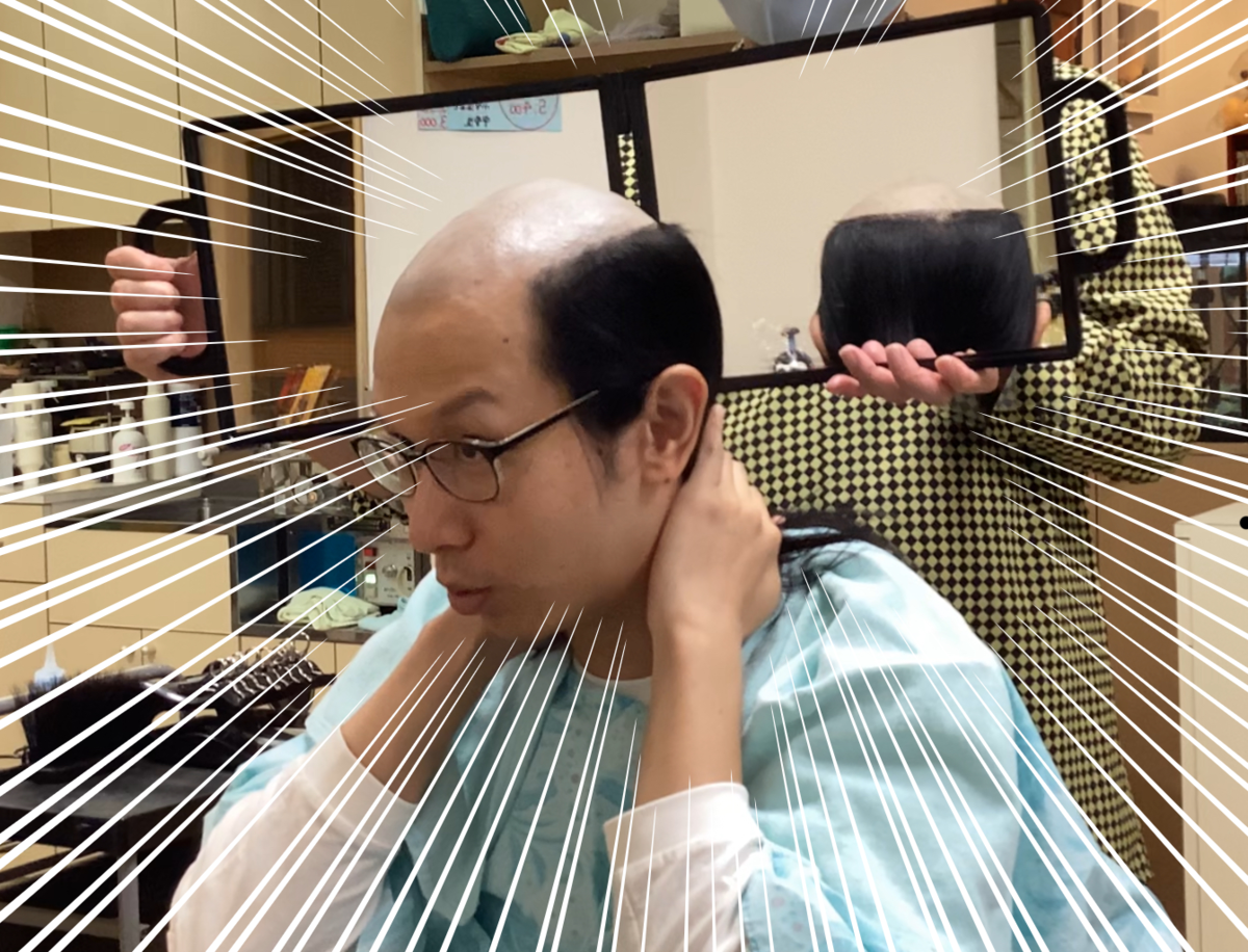 【地毛でちょんまげ】月代(さかやき)を作ろう!!! - magemeganeの日記