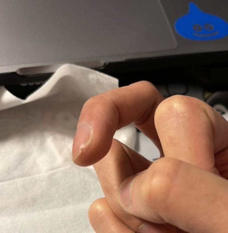 MacBookのステッカー剥がし作業で欠けた爪