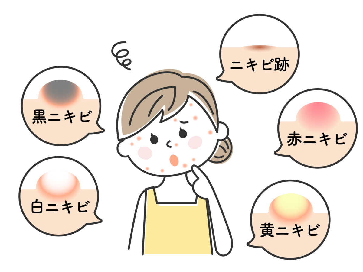 ニキビがある時、ニキビ用のスキンケアを使うのが正しいのか?