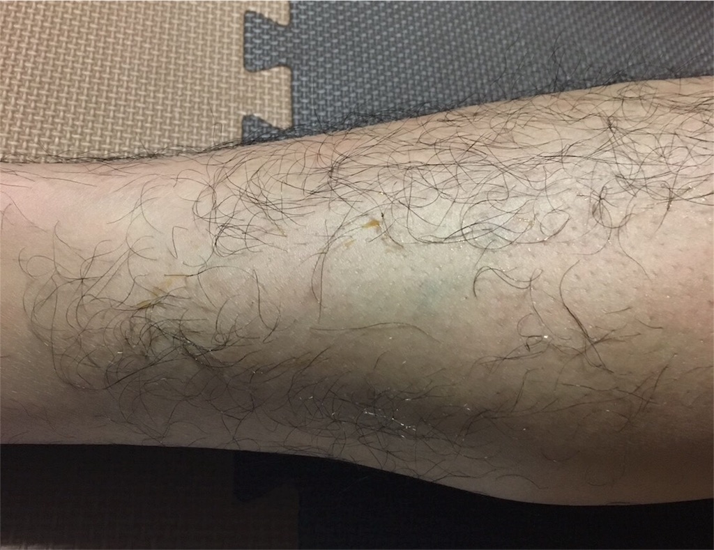 f:id:mako0625:20170630070047j:image