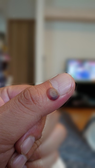 f:id:malamili:20210918154550j:image