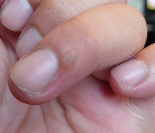 f:id:malamili:20210918154719j:image