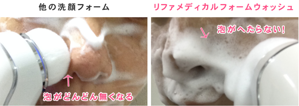 f:id:mamabiyou:20161101112716j:plain リファメディカルフォームウォッシュ