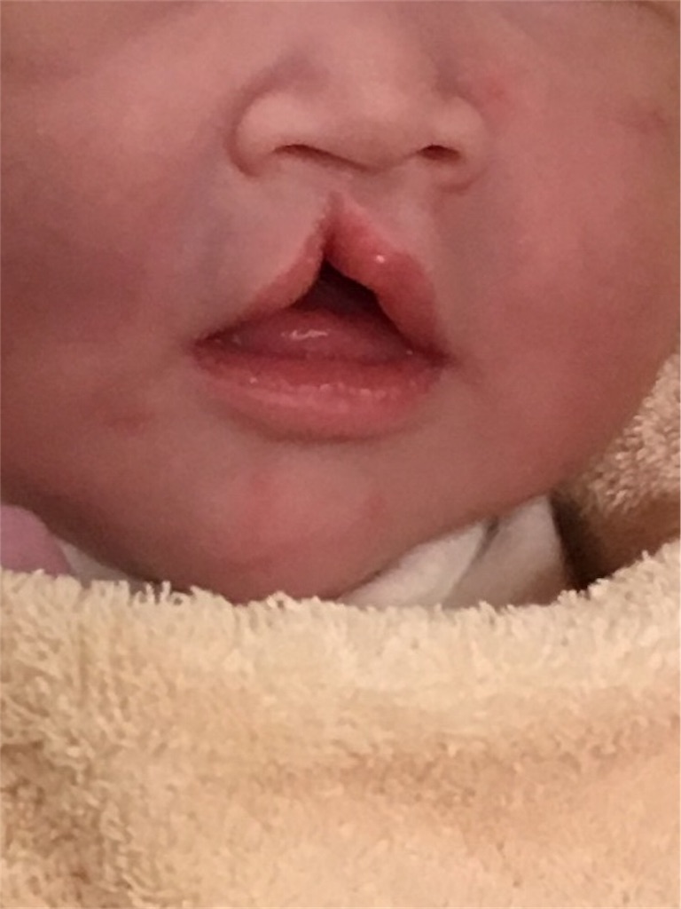 f:id:maman365smile:20190826150511j:image