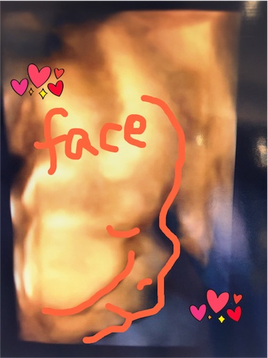 f:id:mamashizue:20161020193246j:image