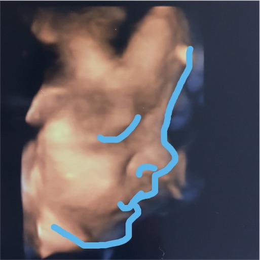 f:id:mamashizue:20161020193258j:image