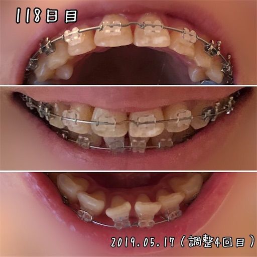 f:id:mamatara:20190517140409j:image f:id:mamatara:20190517140409j:image