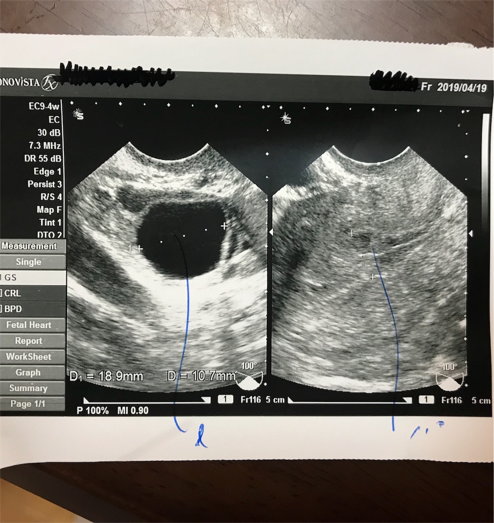 f:id:mami1983:20190505222934j:image f:id:mami1983:20190505222934j:image