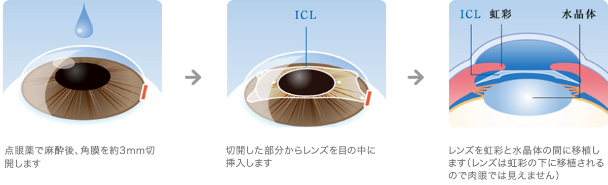f:id:manabe-clinic:20210521073952p:plain