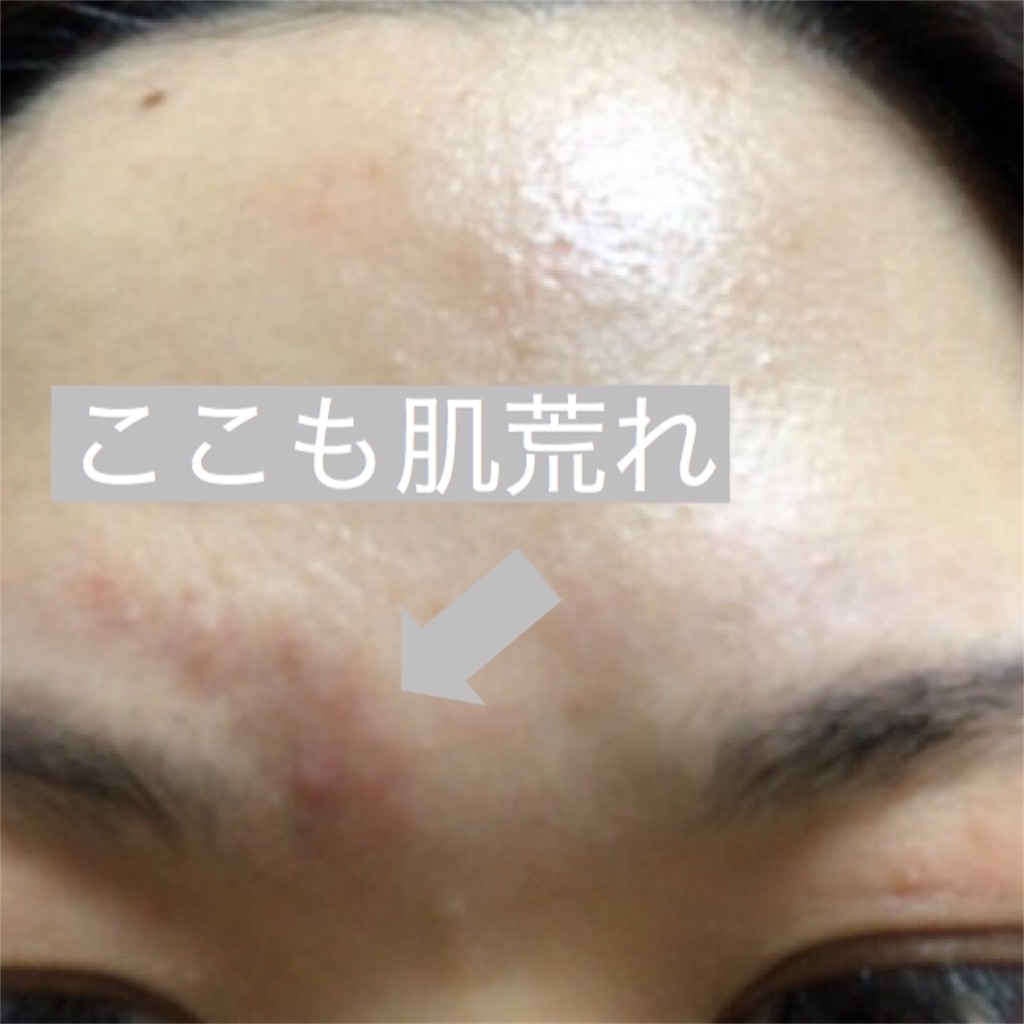 ミノン 口コミ 乾燥肌でも使えるの 保湿力が物足りない トライアルセット使ってみた ワンオペ専業主婦が快適に生活するためのブログ ミノン 口コミ 乾燥肌でも使えるの 保湿力が物足りない トライアルセット使ってみた ワンオペ専業主婦が快適に生活するためのブログ