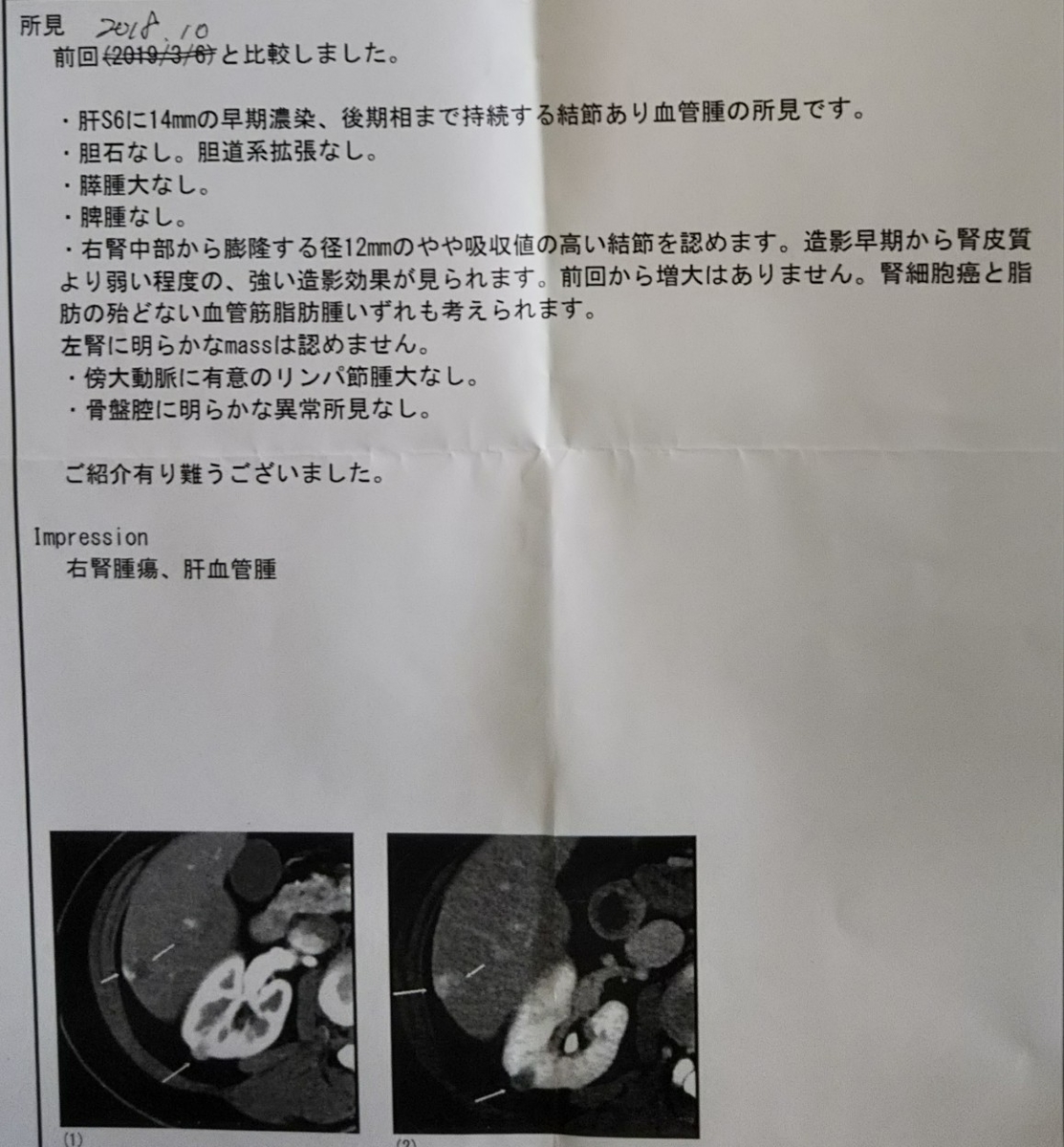 f:id:manmaruheart:20190329144937j:plain f:id:manmaruheart:20190329144937j:plain