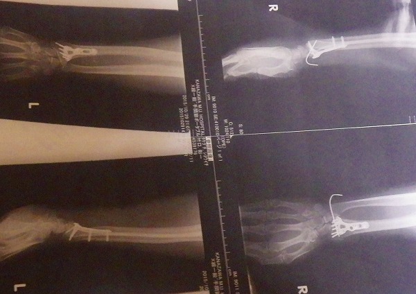 f:id:mannenNA:20200515152610j:plain f:id:mannenNA:20200515152610j:plain