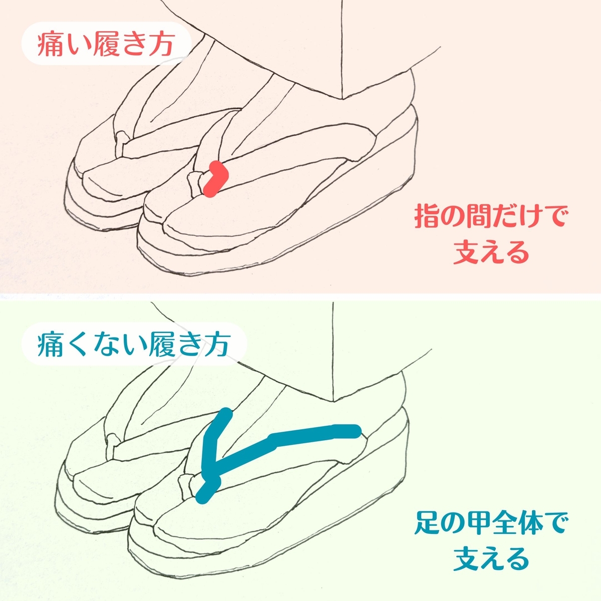 下駄 痛く ならない 方法