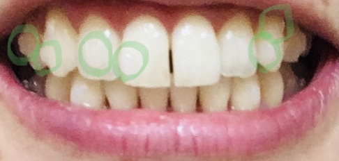f:id:maribaron_tokyo:20220103154118j:plain