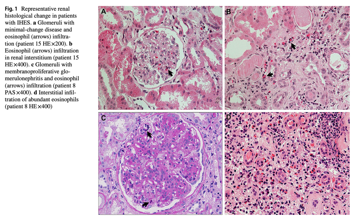f:id:mark_nephrologist:20211207134310p:plain