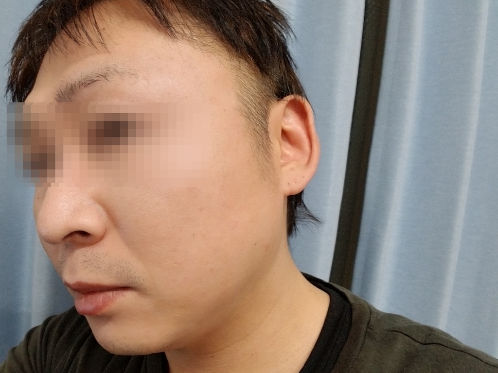 f:id:marumarudai:20190210230150j:plain ツーブロック、バリカン後