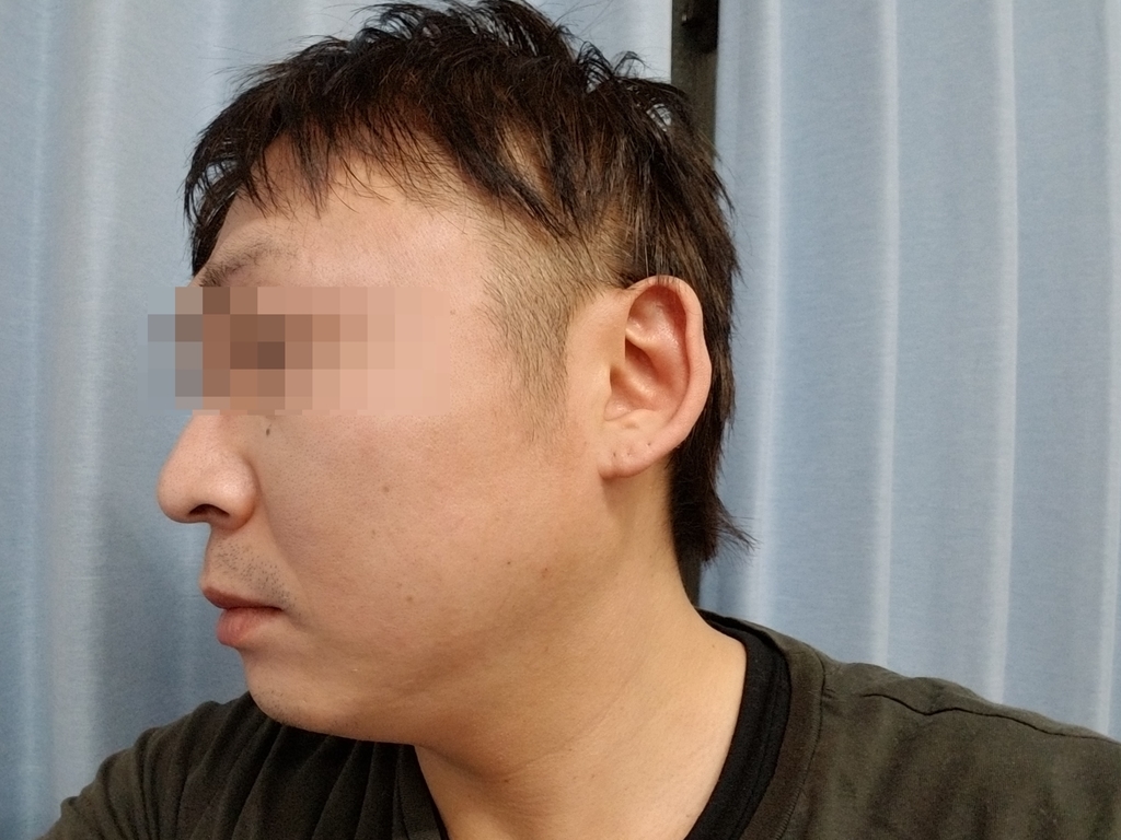 f:id:marumarudai:20190210230226j:plain ツーブロック、バリカン後