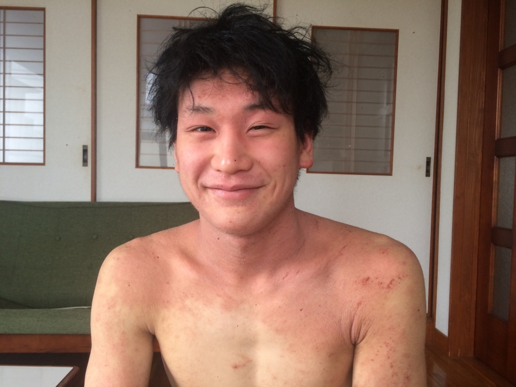 f:id:marumonomkitee:20180303184137j:plain f:id:marumonomkitee:20180303184137j:plain