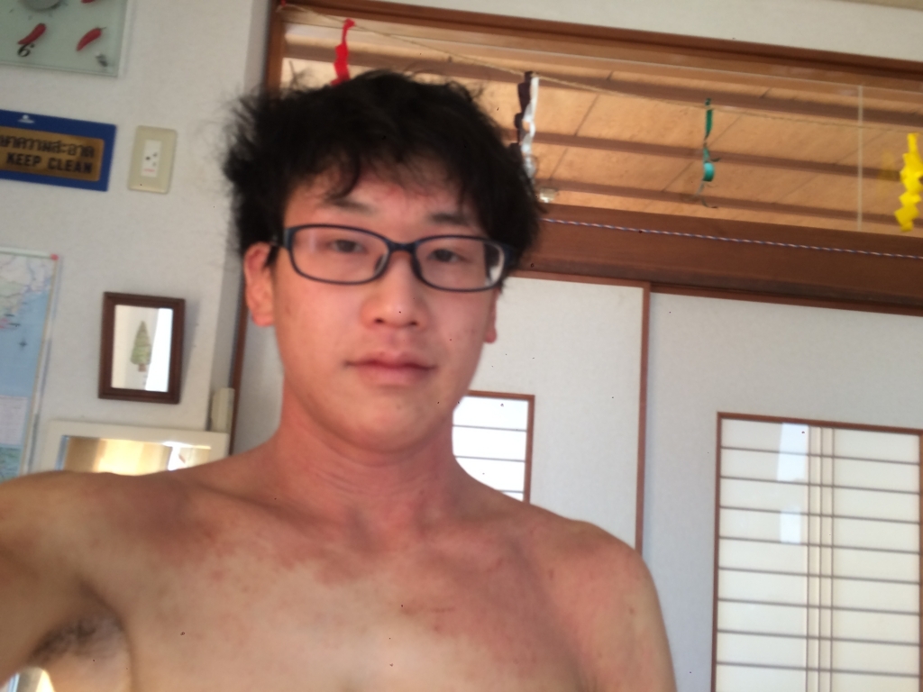 f:id:marumonomkitee:20180303184504j:plain f:id:marumonomkitee:20180303184504j:plain