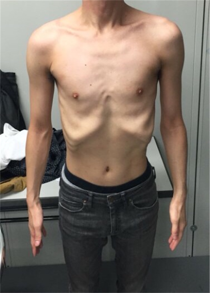 はじめまして 元自衛隊が教える たった10分 ジムに通うことなく アンガールズのようなガリガリからスーツが似合うモテる細マッチョ体型を手に入れる自衛隊式胸筋トレーニングメソッド